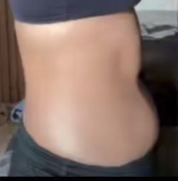 Belly that is divided in two parts horizontally?