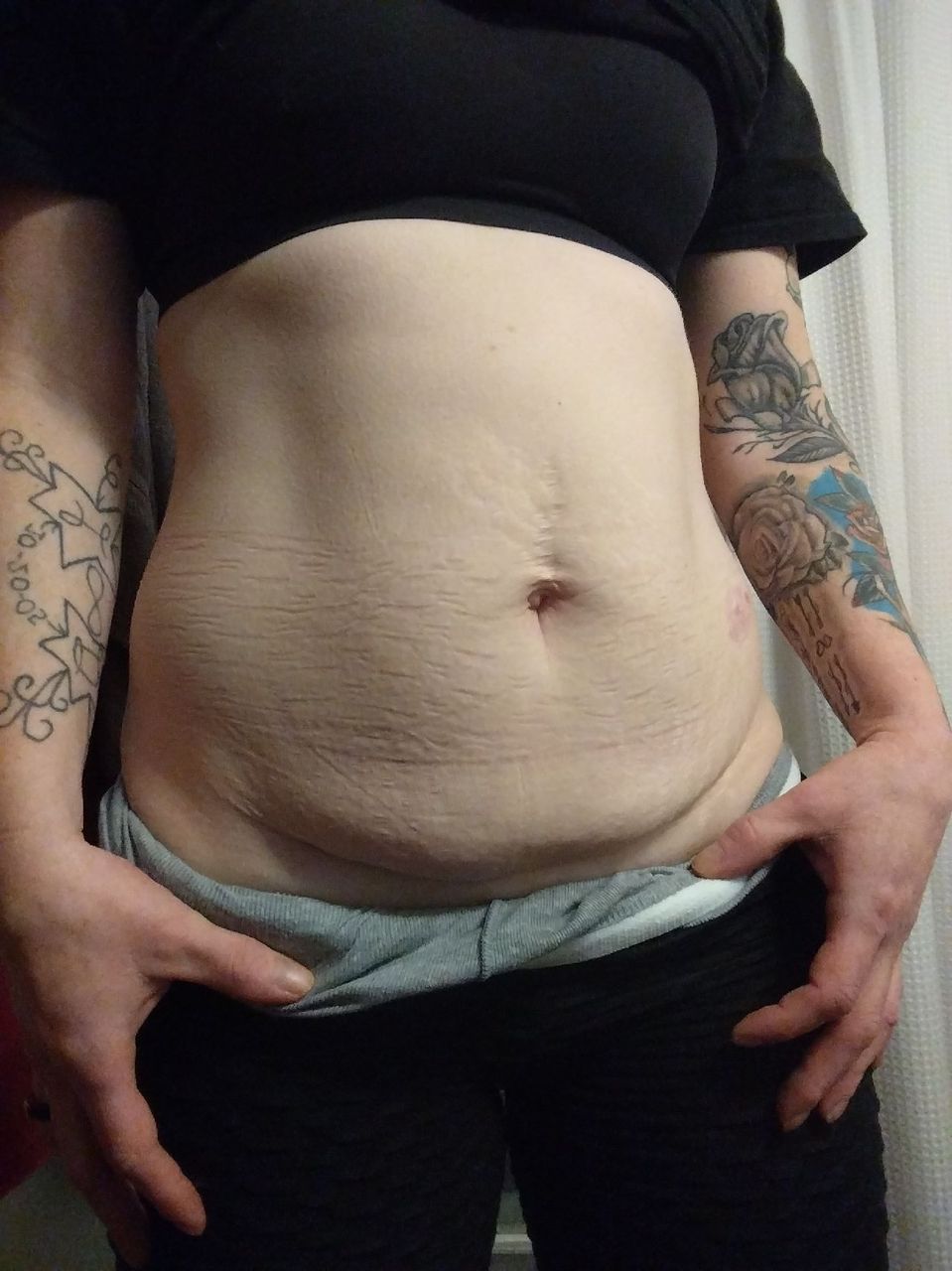 Tips on lose skin? Will it tighten as you progress?