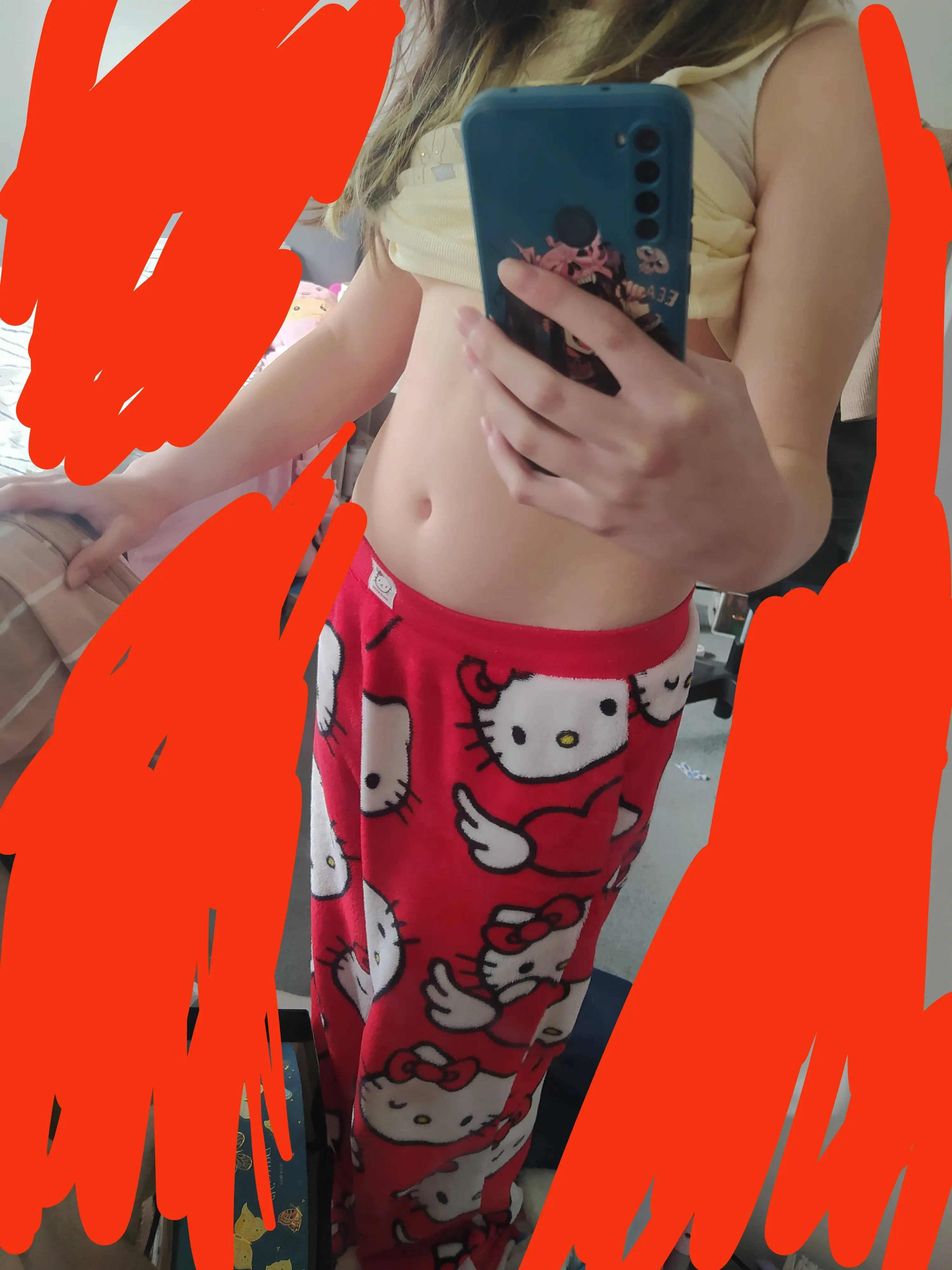 TW⚠️ eating disorder