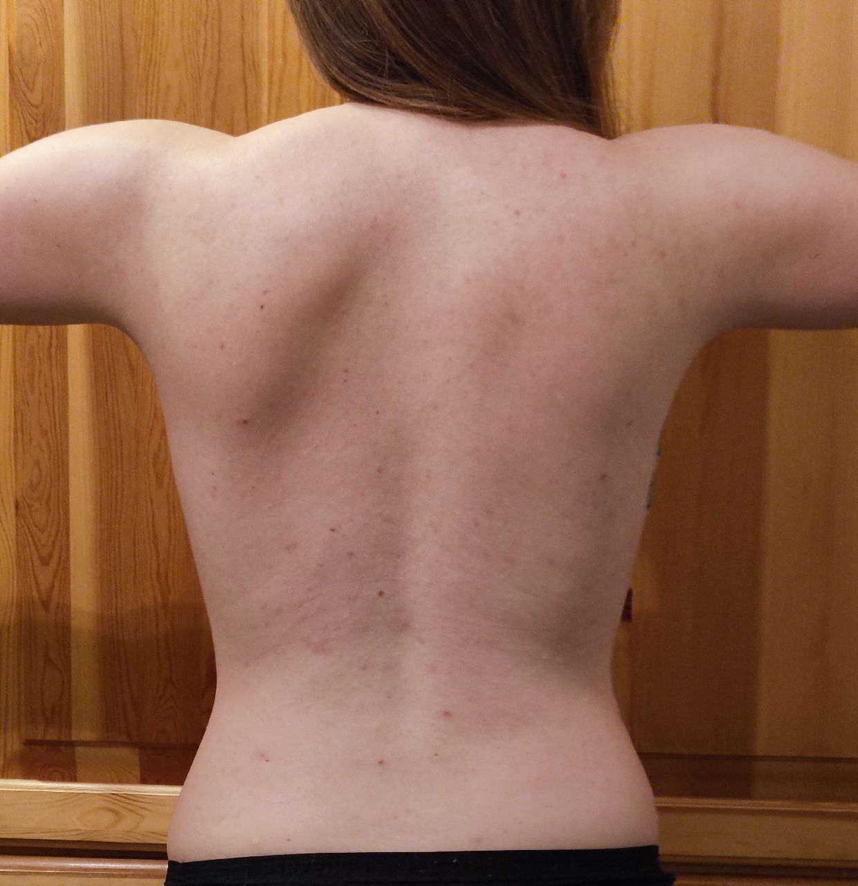 Before After Transformation - Before & After Progress ~4 months